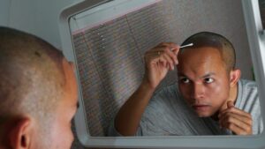 Un soin des cheveux après une greffe de cheveux pour hommes