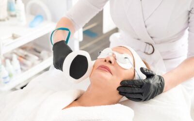 Lasers esthétiques : quelles sont les meilleures options pour un teint uniforme ?