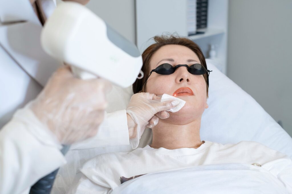 laser esthetique peau